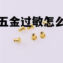 做五金过敏怎么办，在五金厂做手过敏了怎么办